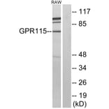 Western Blot - Anti-GPR115 Antibody (G123) - Antibodies.com