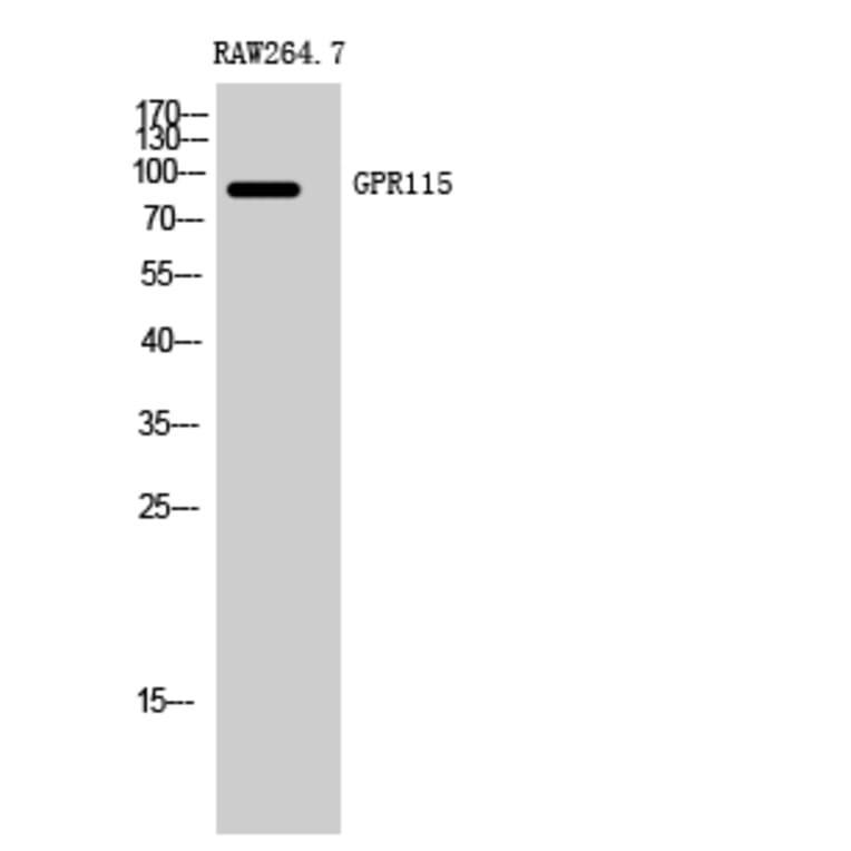 Western Blot - Anti-GPR115 Antibody (G123) - Antibodies.com