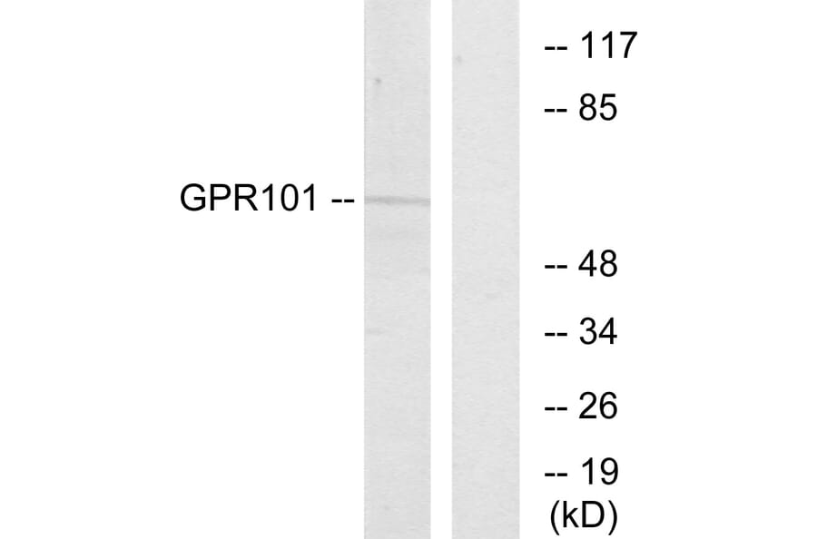 Western Blot - Anti-GPR101 Antibody (G278) - Antibodies.com