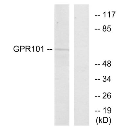 Western Blot - Anti-GPR101 Antibody (G278) - Antibodies.com