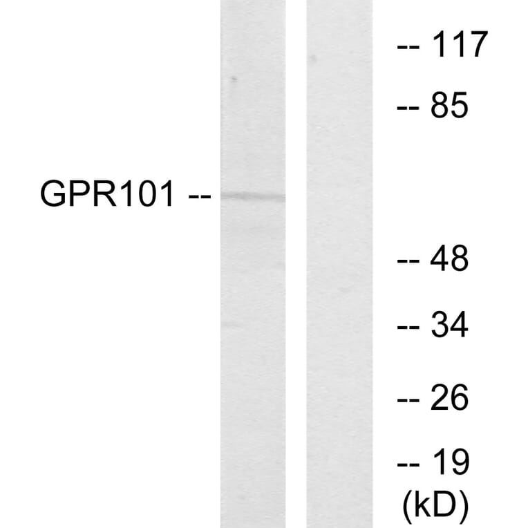 Western Blot - Anti-GPR101 Antibody (G278) - Antibodies.com