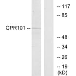 Western Blot - Anti-GPR101 Antibody (G278) - Antibodies.com