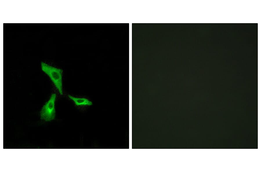 Immunofluorescence - Anti-GPR101 Antibody (G278) - Antibodies.com
