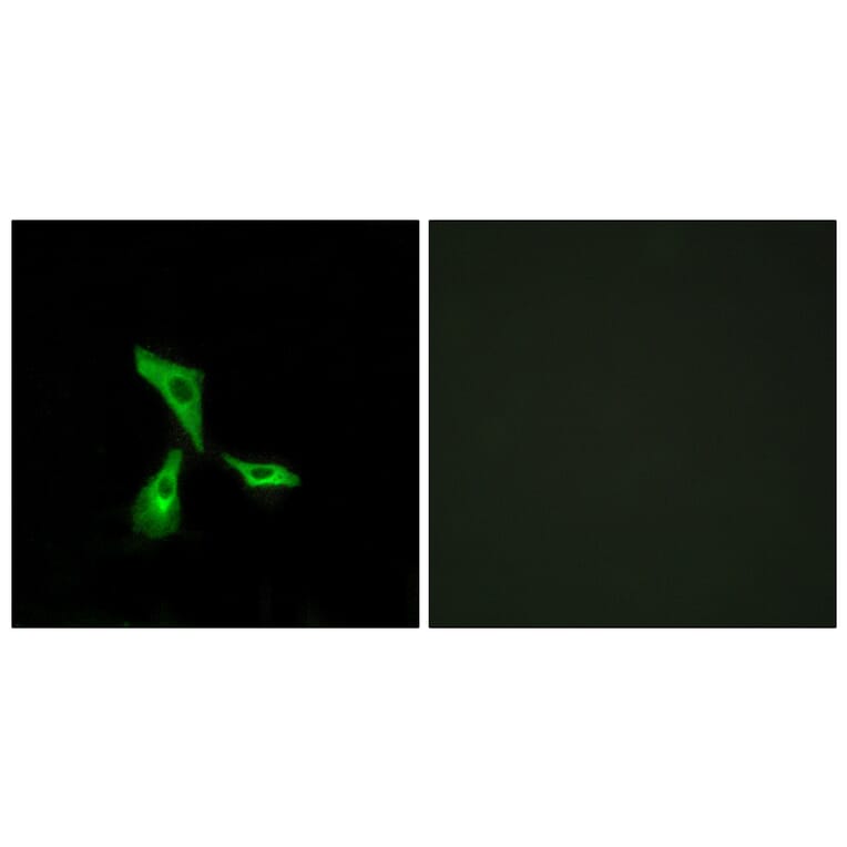 Immunofluorescence - Anti-GPR101 Antibody (G278) - Antibodies.com