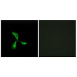 Immunofluorescence - Anti-GPR101 Antibody (G278) - Antibodies.com
