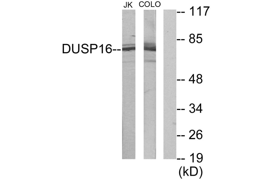 Western Blot - Anti-DUSP16 Antibody (C11640) - Antibodies.com