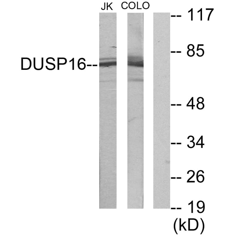 Western Blot - Anti-DUSP16 Antibody (C11640) - Antibodies.com