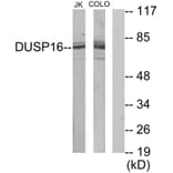 Western Blot - Anti-DUSP16 Antibody (C11640) - Antibodies.com