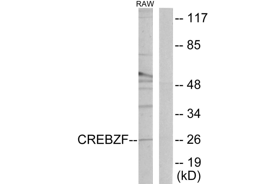 Western Blot - Anti-CREBZF Antibody (C11755) - Antibodies.com