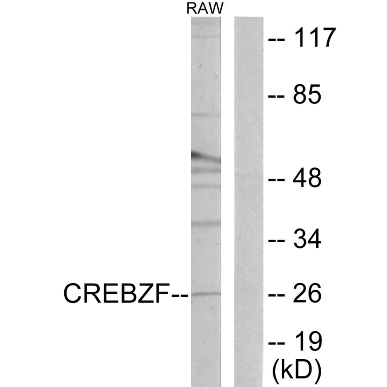 Western Blot - Anti-CREBZF Antibody (C11755) - Antibodies.com