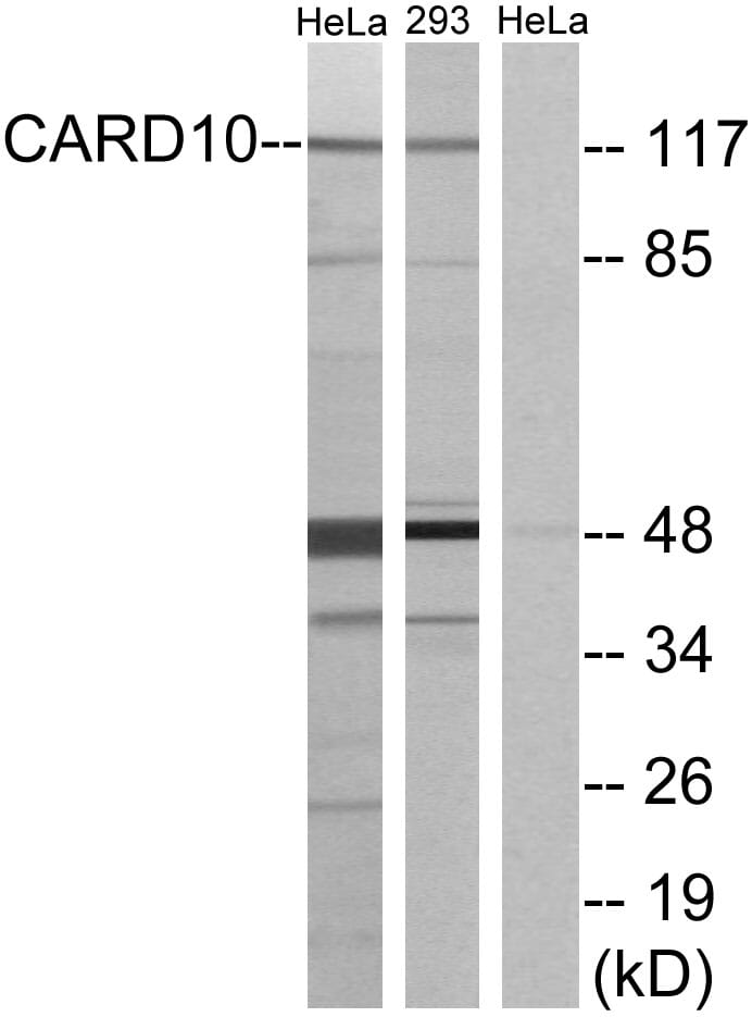Western blot analysis of lysates from HeLa and 293 cells using Anti-CARD10 Antibody. The right hand lane represents a negative control, where the antibody is blocked by the immunising peptide.