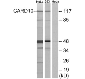 Western Blot - Anti-CARD10 Antibody (C12112) - Antibodies.com