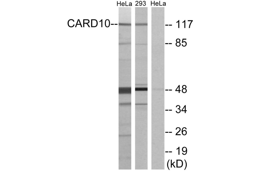 Western Blot - Anti-CARD10 Antibody (C12112) - Antibodies.com