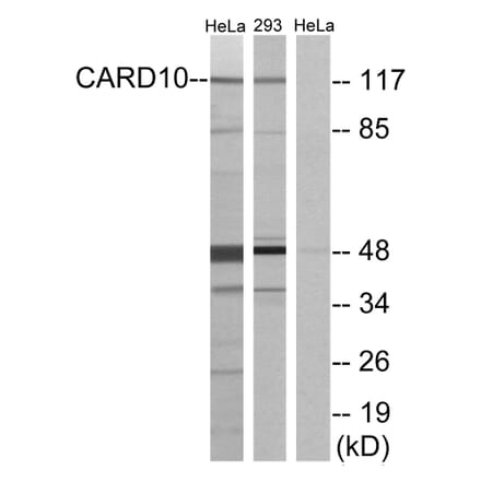 Western Blot - Anti-CARD10 Antibody (C12112) - Antibodies.com