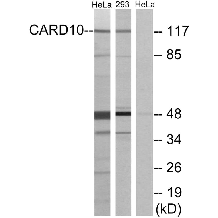 Western Blot - Anti-CARD10 Antibody (C12112) - Antibodies.com