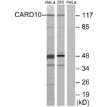 Western Blot - Anti-CARD10 Antibody (C12112) - Antibodies.com