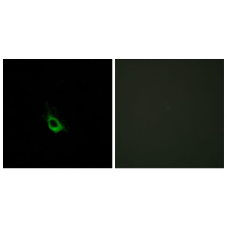 Immunofluorescence - Anti-CARD10 Antibody (C12112) - Antibodies.com