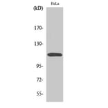 Western Blot - Anti-CARD10 Antibody (C12112) - Antibodies.com