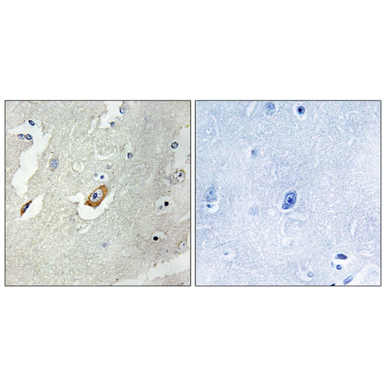 Immunohistochemistry - Anti-CDC16 Antibody (B1027) - Antibodies.com