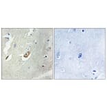 Immunohistochemistry - Anti-CDC16 Antibody (B1027) - Antibodies.com