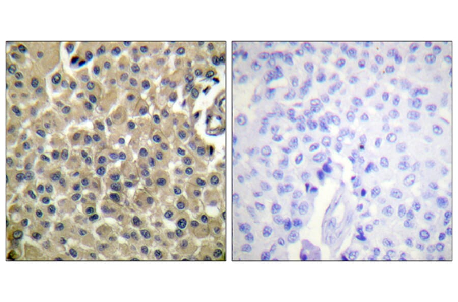 Immunohistochemistry - Anti-CD227 Antibody (B0844) - Antibodies.com
