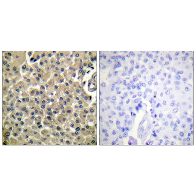 Immunohistochemistry - Anti-CD227 Antibody (B0844) - Antibodies.com