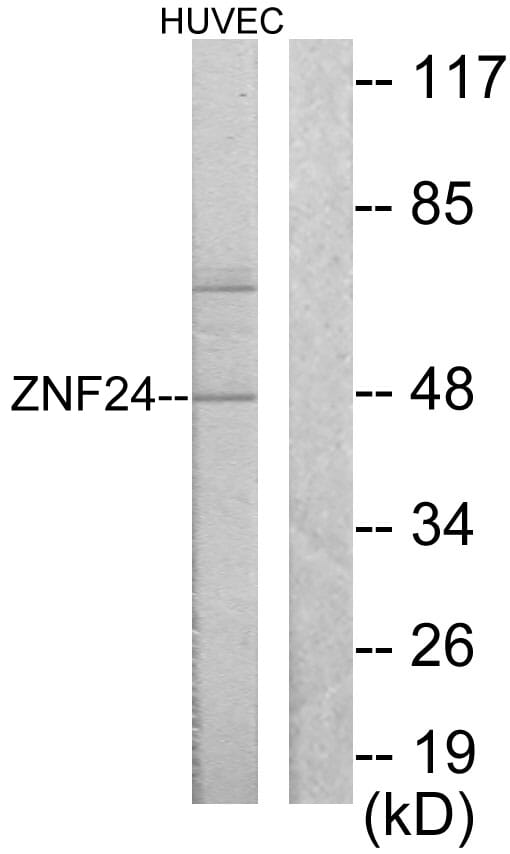 Western blot analysis of lysates from HUVEC cells using Anti-ZNF24 Antibody. The right hand lane represents a negative control, where the antibody is blocked by the immunising peptide.