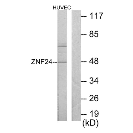 Western Blot - Anti-ZNF24 Antibody (C10397) - Antibodies.com