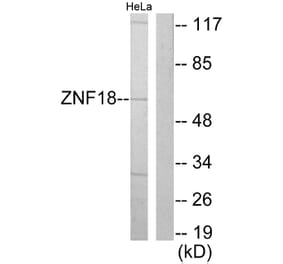 Western Blot - Anti-ZNF18 Antibody (C10394) - Antibodies.com