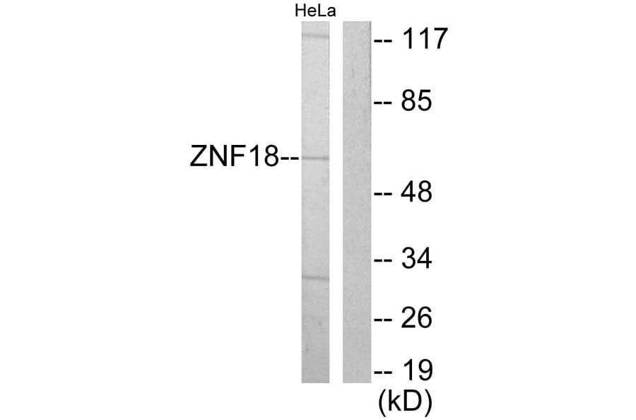 Western Blot - Anti-ZNF18 Antibody (C10394) - Antibodies.com