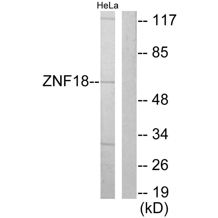 Western Blot - Anti-ZNF18 Antibody (C10394) - Antibodies.com