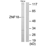 Western Blot - Anti-ZNF18 Antibody (C10394) - Antibodies.com