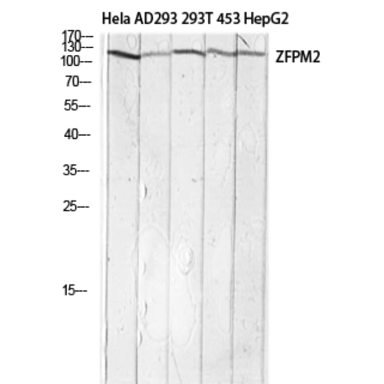 Western Blot - Anti-ZFPM2 Antibody (C30989) - Antibodies.com