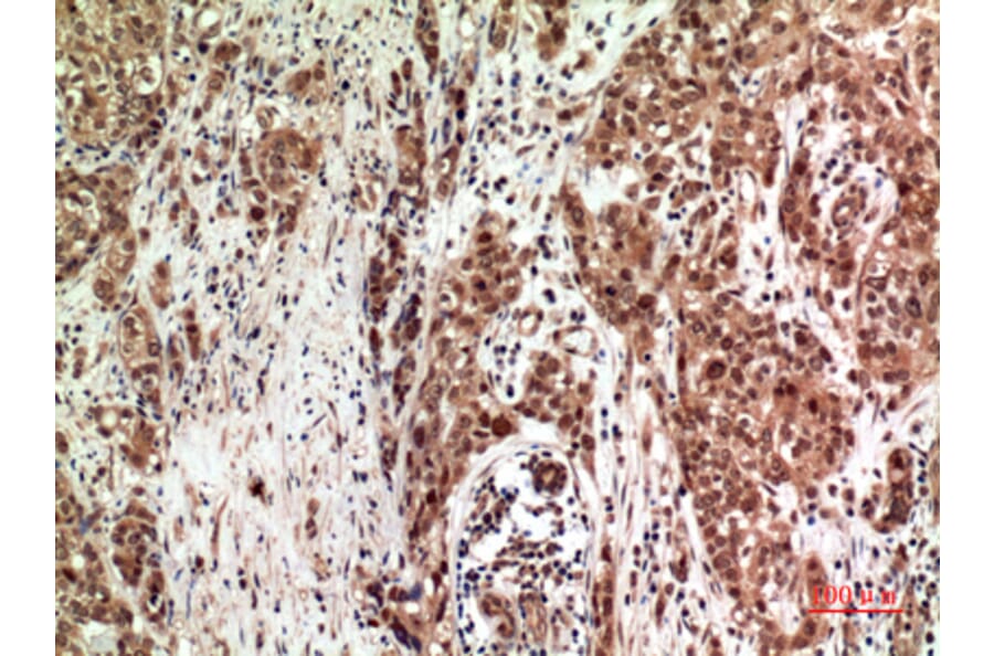 Immunohistochemistry - Anti-ZFPM2 Antibody (C30989) - Antibodies.com