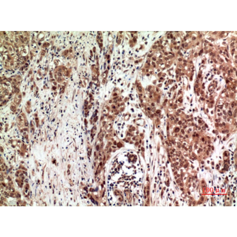 Immunohistochemistry - Anti-ZFPM2 Antibody (C30989) - Antibodies.com