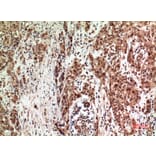 Immunohistochemistry - Anti-ZFPM2 Antibody (C30989) - Antibodies.com