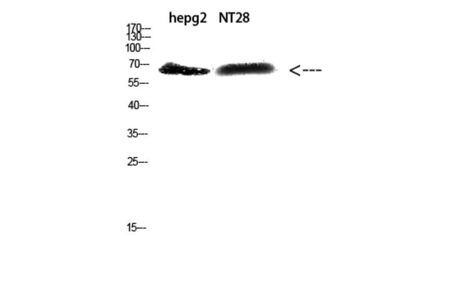 Western Blot - Anti-ZFP91 Antibody (C30898) - Antibodies.com