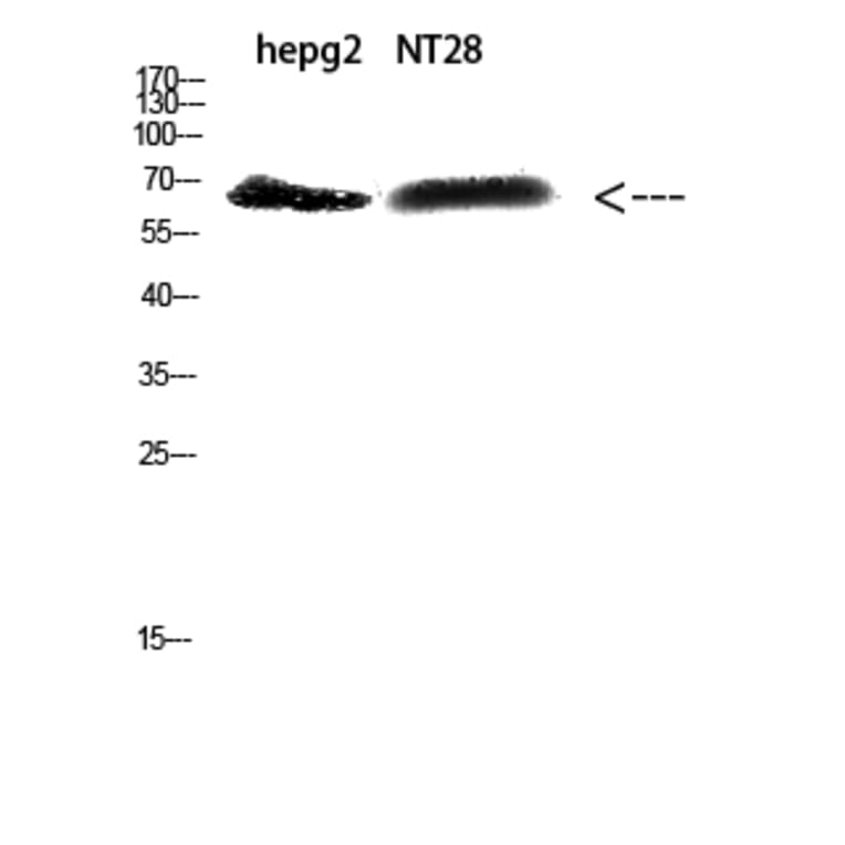Western Blot - Anti-ZFP91 Antibody (C30898) - Antibodies.com