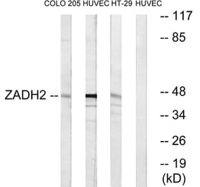 Western Blot - Anti-ZADH2 Antibody (C19634) - Antibodies.com