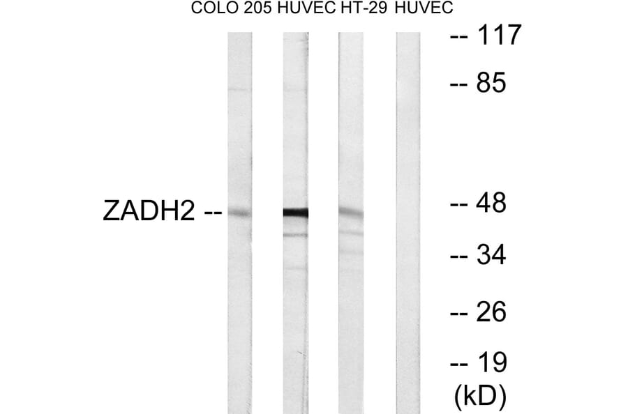 Western Blot - Anti-ZADH2 Antibody (C19634) - Antibodies.com