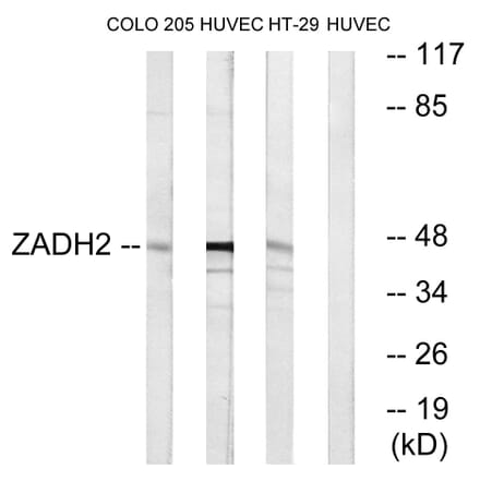 Western Blot - Anti-ZADH2 Antibody (C19634) - Antibodies.com