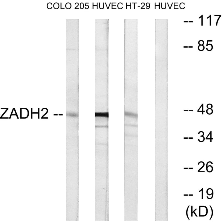 Western Blot - Anti-ZADH2 Antibody (C19634) - Antibodies.com