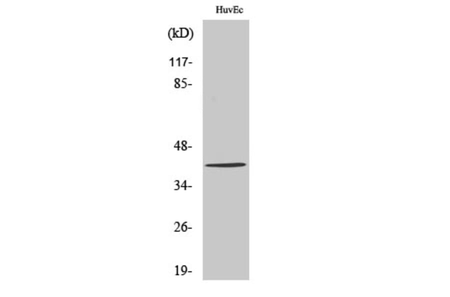 Western Blot - Anti-ZADH2 Antibody (C19634) - Antibodies.com