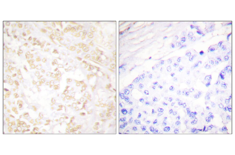 Immunohistochemistry - Anti-XRCC6 Antibody (C0400) - Antibodies.com