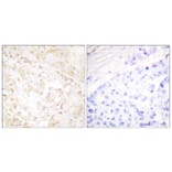 Immunohistochemistry - Anti-XRCC6 Antibody (C0400) - Antibodies.com