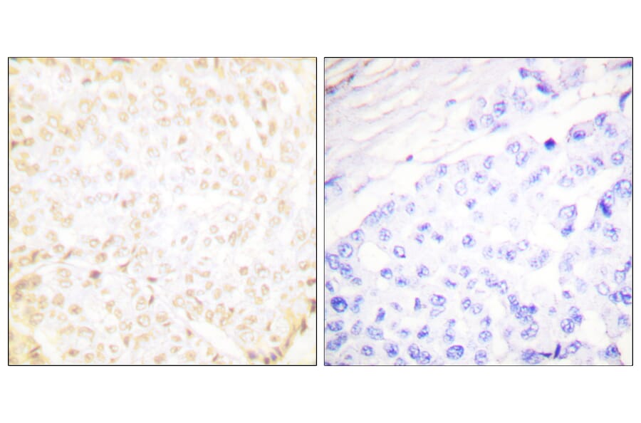 Immunohistochemistry - Anti-XRCC5 Antibody (C0399) - Antibodies.com