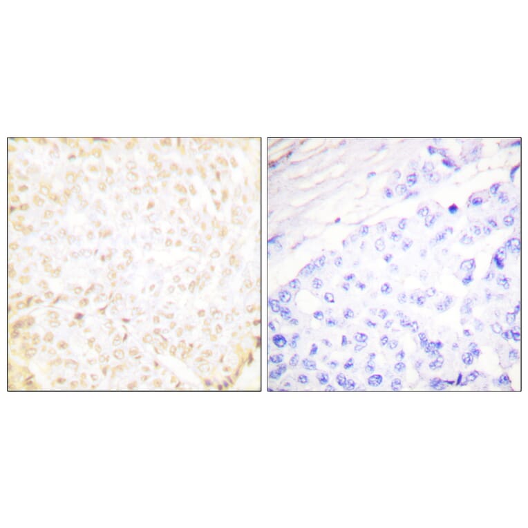 Immunohistochemistry - Anti-XRCC5 Antibody (C0399) - Antibodies.com