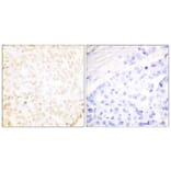 Immunohistochemistry - Anti-XRCC5 Antibody (C0399) - Antibodies.com