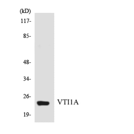 Western Blot - Anti-VTI1A Antibody (R12-3679) - Antibodies.com