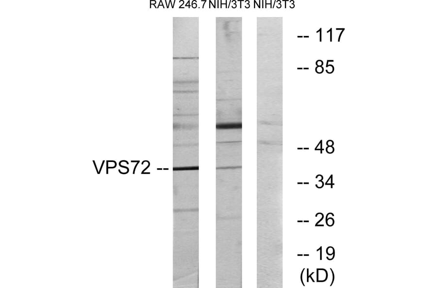 Western Blot - Anti-VPS72 Antibody (C11112) - Antibodies.com